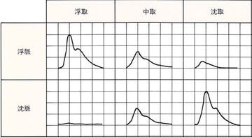 浮沈脈