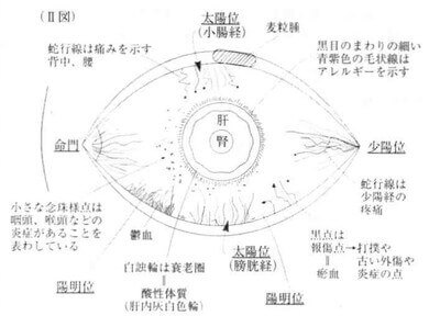 眼診図