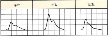 平脈