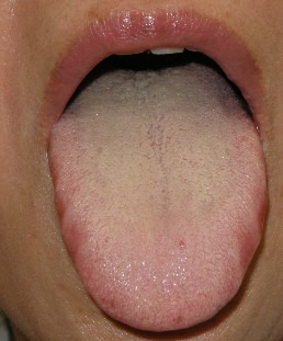 紅舌3
