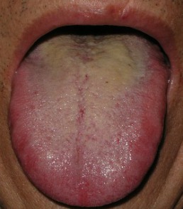 紅舌1