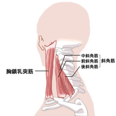 胸鎖乳突筋斜角筋