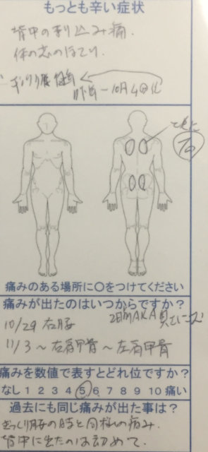 ぎっくり背中になりぎっくり腰と同様の刺し込み痛、他院で治らず整体鍼灸で改善した一症例