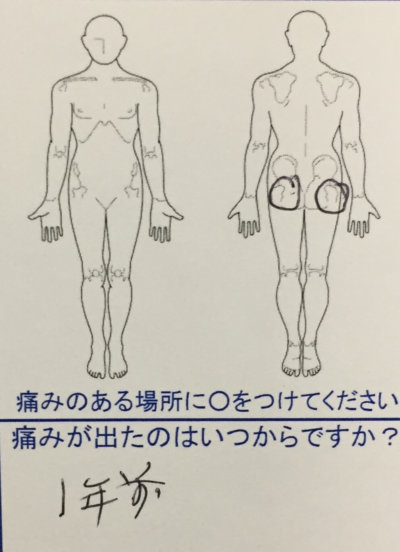 整骨院で腰痛が治らない60代男性【1年前からの慢性的な腰痛】整体鍼灸で改善した一症例