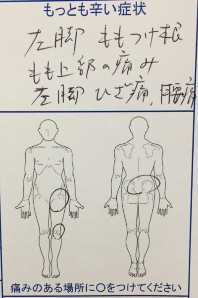 左足を襲った激痛（もも付け根、もも上部、膝痛）と腰痛で来院された50代女性の一症例