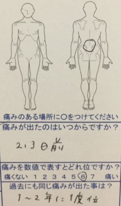 1～2年に一度のぎっくり腰寸前で来院された40代女性の一症例