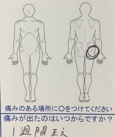 ゴルフをやって腰痛【ヨガもやっている】整体と体の使い方を伝えて改善した一症例