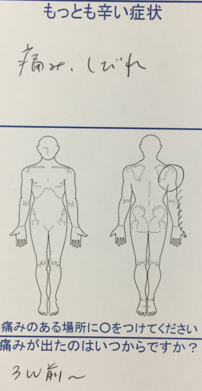 右肩から腕の痛みとしびれ【3週間前から】で来院された40代男性の一症例