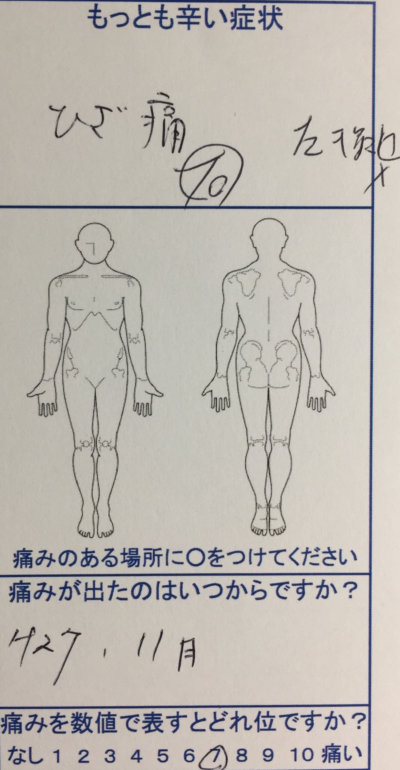 【整形外科で変形性ひざ関節症と診断】2年間注射を続けるが改善しなかった膝痛から開放された一症例