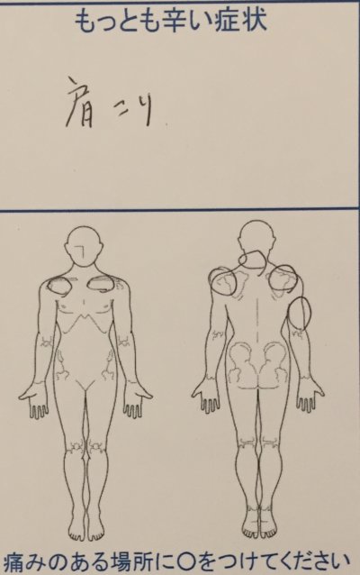 肩がコリすぎて右腕しびれ【荷物も持てない】治療で改善した40代女性の1症例