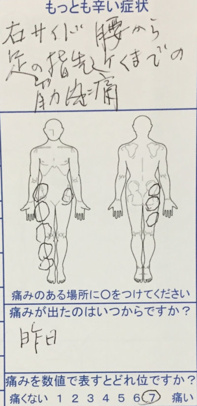 突然の右ふとももから腰にかけての激痛で歩けなくなった80代女性の1症例