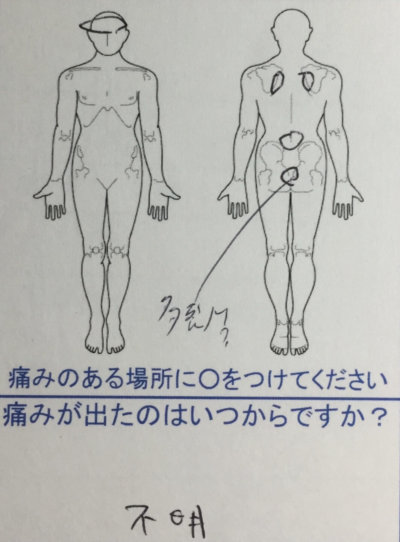 ずっと背中が痛く頭痛もある【姿勢が良すぎる】30代男性の1症例