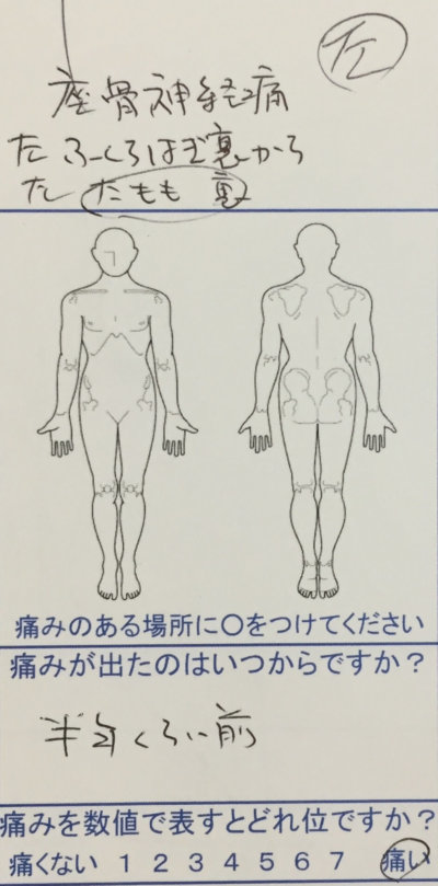 イスに座れないほどの坐骨神経痛【太もも~ふくらはぎ】50代女性の痛みが改善した1症例