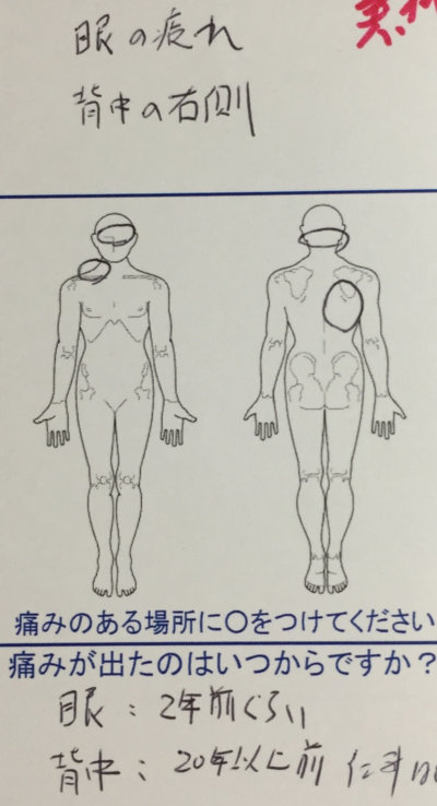 眼の疲れや背中右側の痛み【サッカーで傷めた古傷が原因】バランスを改善していった1症例