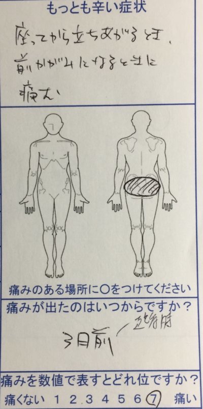 歩くのも寝転ぶも辛い腰痛【1回の治療でよくなった】1症例