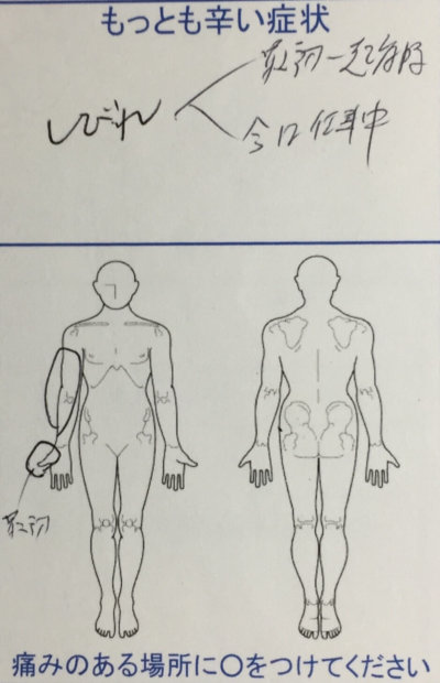 右腕から右親指のしびれ【肩こりもあり】しびれ症状がなくなった1症例