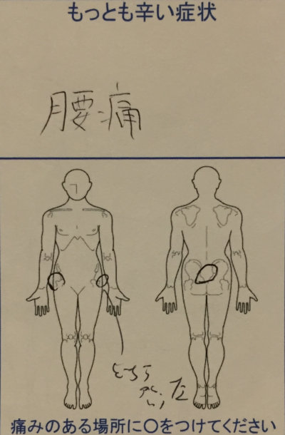 高校生の腰痛【腹斜筋の痛みも】サッカーすると腰が痛い整体で改善した1症例