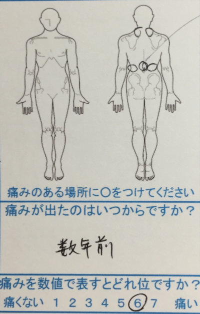 突然の腰痛【慢性的な首肩のコリ】早く改善した30代女性の1症例