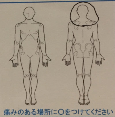 頭痛と肩こり陰虚による寝汗【MRI問題なしだった】30代女性の1症例