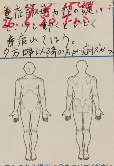 疲れがひどく肩こり冷え性【重症筋無力症疑い】40代女性の1症例