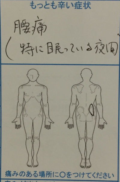 夜に腰が痛い【眠っている夜間の腰痛】整体治療で改善した50代女性1症例
