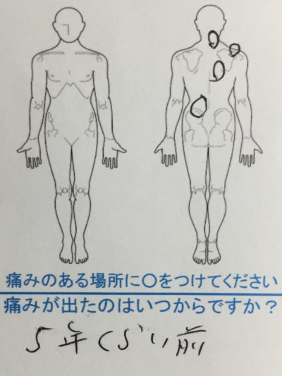 ５年前から左腰ヘルニア→右首右背中の痛み40代男性の1症例