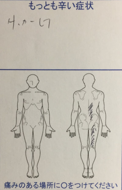 サッカーで腰を痛めた【右足しびれもあり】痛みが改善した1症例