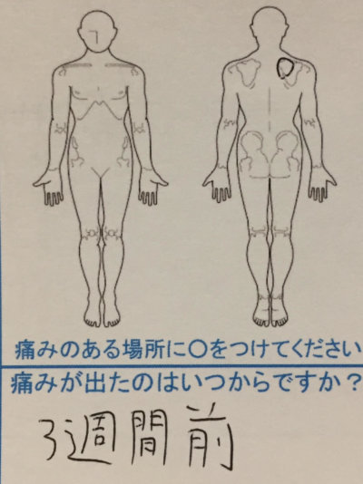 3週間前から右肩が痛い【SE20代男性】の鍼灸治療1症例