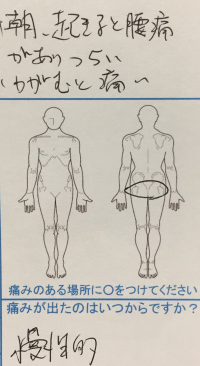 朝起きると腰が痛く辛い【かがむと腰痛悪化】30代男性の1症例