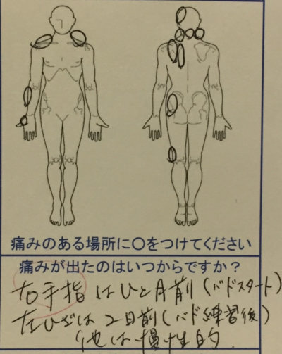 右手の痛み【背肩腰の張りから頭痛が慢性的】バドミントンで痛めた40代女性の1症例