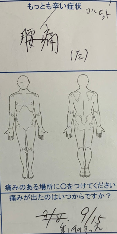 重いものを持って腰を痛めた【男のギックリ腰】1回でかなり改善した1症例